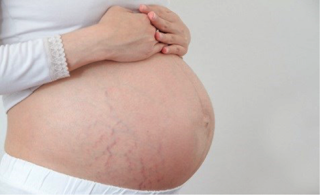ran da khi mang thai tuan 29 - Mang thai tuần thứ 29 và những điều mẹ cần biết